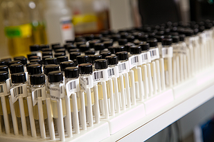 Bacterial stab vials in test tube rack