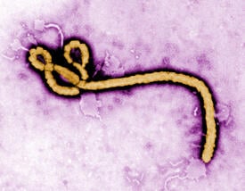 ebola virus viron