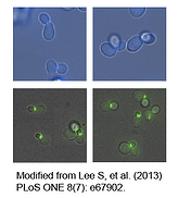 fluorescently tagged yeast cells under a microscope