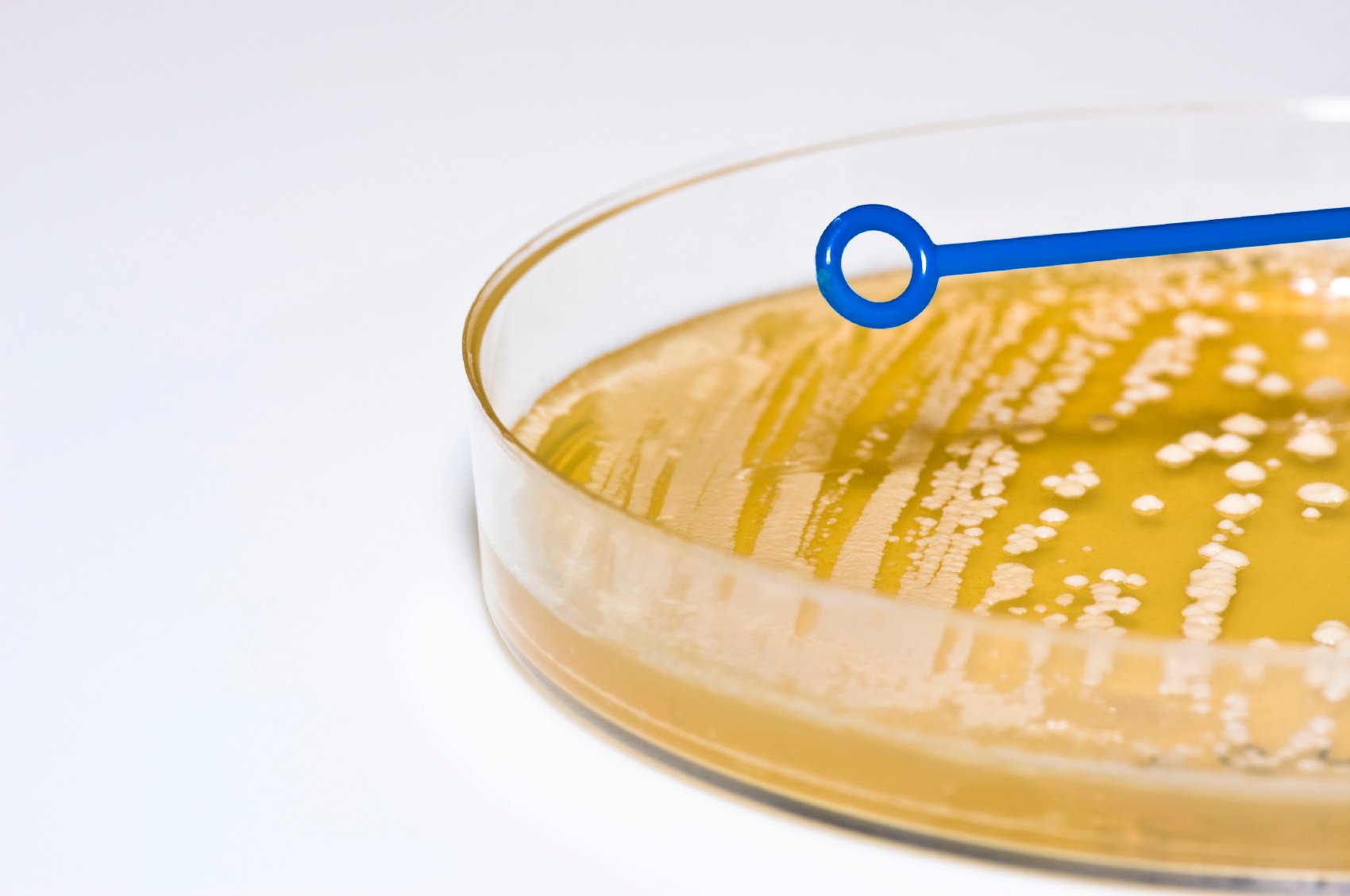 escherichia coli acid fast stain