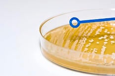 inoculation loop over agar plate