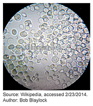 Budding yeast (Saccharomyces cerevisiae)