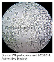 Budding yeast (Saccharomyces cerevisiae)