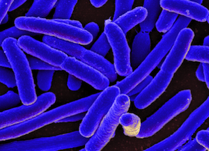 Colorized scanning electron micrograph of Escherichia coli