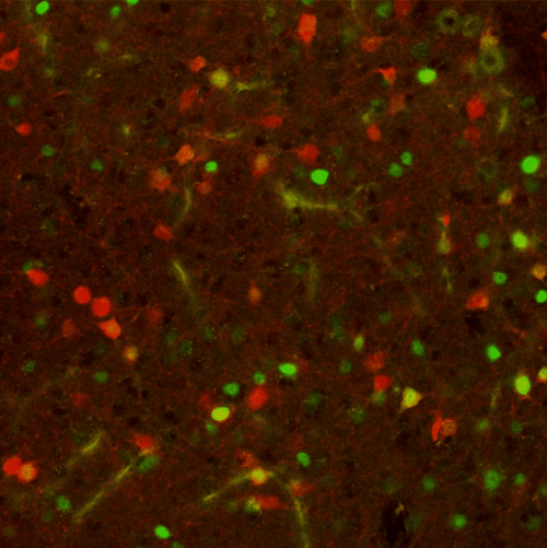 Confocal image of periaqueductal gray