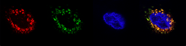 Micrographs of biosensors expressed in human cell lines