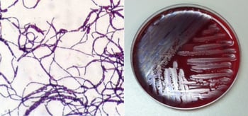 Bacteria under a microscope and on an agar plate