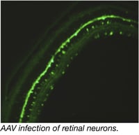 AAV Infection of Retinal Neurons 