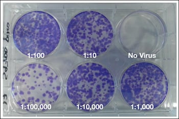 Lentivirus Crystal Violet Image