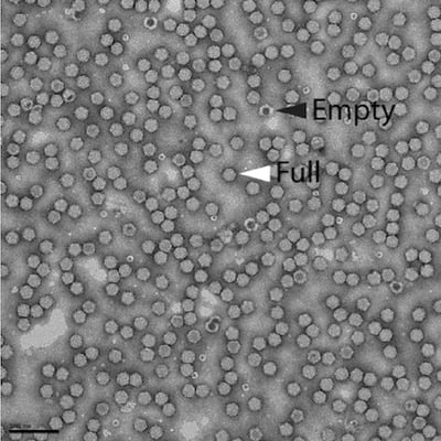 Negative stained AAV viral vector