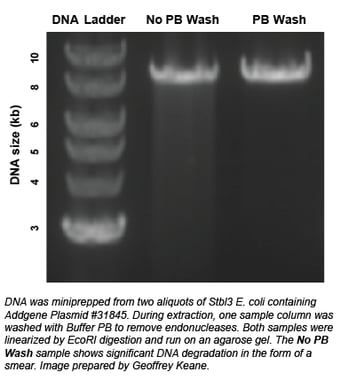 Plasmid prep on agarose gel