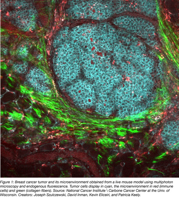 breast cancer microenvironment fluorescence microscopy