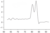 A melting curve with two peaks, indicating two qPCR products
