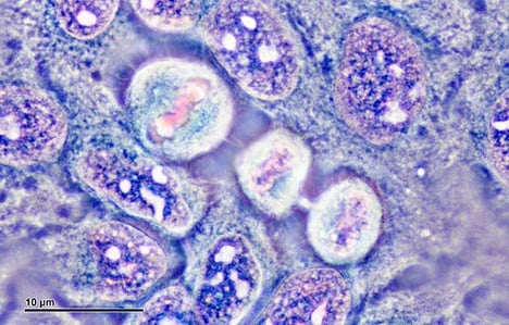 hela cells-min