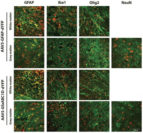 Left, twelve panels showing microscopy images with green and red fluorescence in grey and white matter, in three cells types, with two different genes expressed. Right, two panels showing green and red fluorescence in NeuN cells
