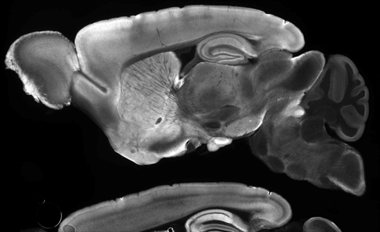 Micrograph of a brain section with fluorescent signal in various regions.