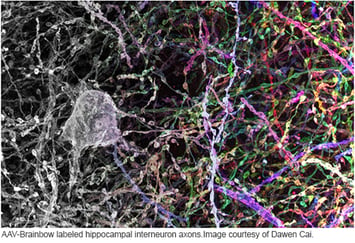 Image of AAV-Brainbow labeled hippocampal interneuron axons.