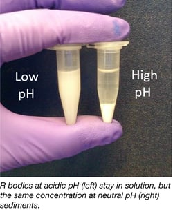 R bodies in acidic pH stay in solution, R bodies at high pH sediments