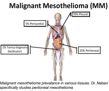 Malignant Mesothelioma