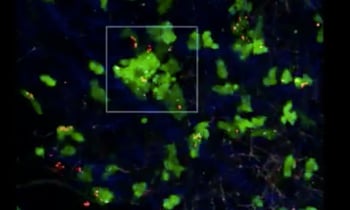 fluorescent protein expression in cells