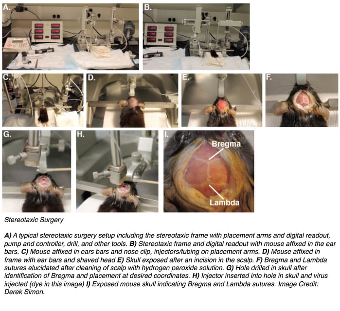 Sterotaxic surgery setup. After a mouse is affixed to the frame via ear bars, its head is shaved. Then the skill is exposed after an incision in the scalp. Cleaning the scalp with a hydrogen peroxide solution helps visualize the bregma and lambda sutures on the scalp. A hole is drilled into the skull at the desired coordinates. An injector is inserted into the hole and virus is injected. 