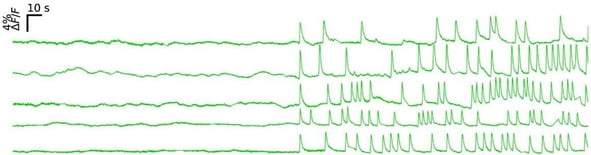Five aligned traces of calcium bursts, showing a sudden transition from no bursts to regular bursts.