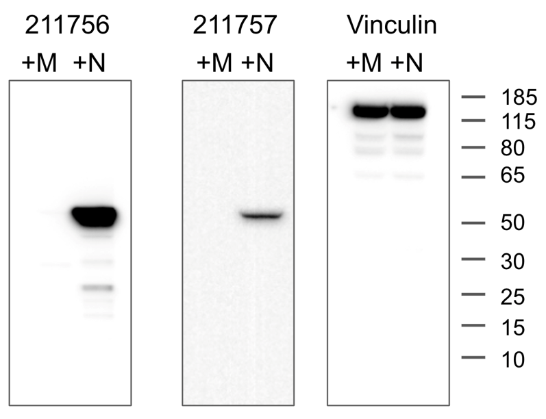 Three western blots. Left, labeled 211756, has no signal in the +M lane, while the +N lane has a major band just above 50 kDa with a few very faint minor bands. Middle, labeled 211757, has no signal in the +M lane, while the +N lane has one clean band just above 50 kDa. Right, labeled Vinculin, has two identical sets of bands in the +M and +N lanes with the major band between 115 and 185 kDa.