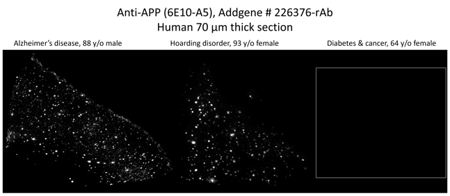 Fig5 anti-APP IHC2-min