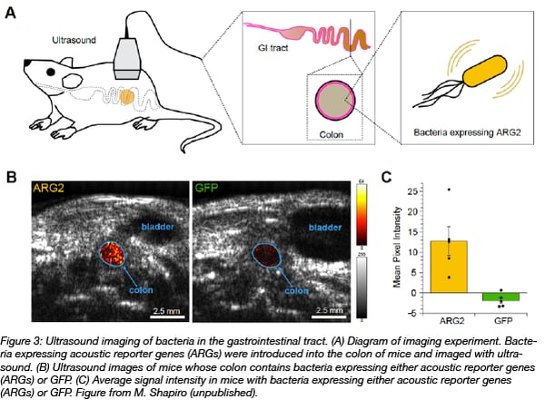 acoustic imaging of bacteria in the GI tract