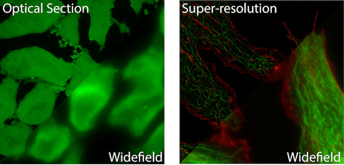 optical section vs super resolution microscopy