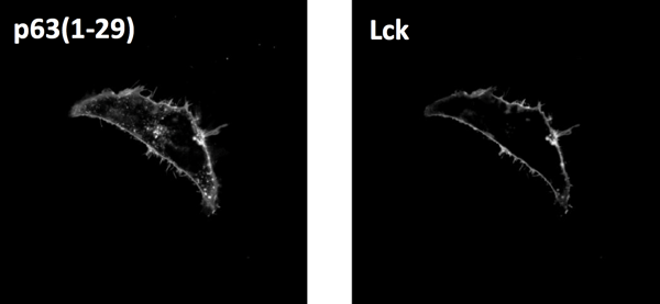 Microscopy image of labelled HeLA cells