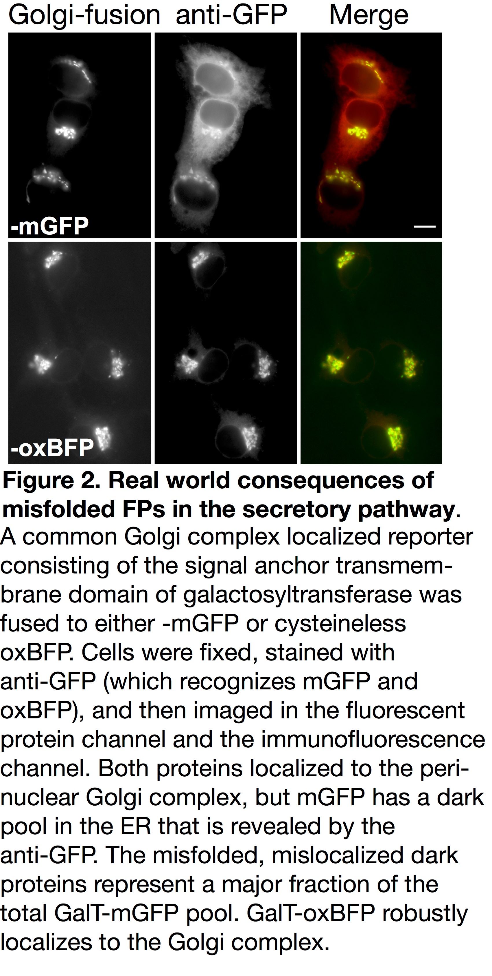 mOX GFP in the golgi complex